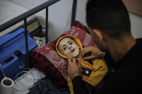 غزة استشهاد 4فلسطينين جراء “سوء التغذيه “.