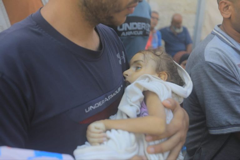 وفاة الطفلة لينا الشيخ خليل بسبب سوء التغذية، ضحية أخرى للجوع