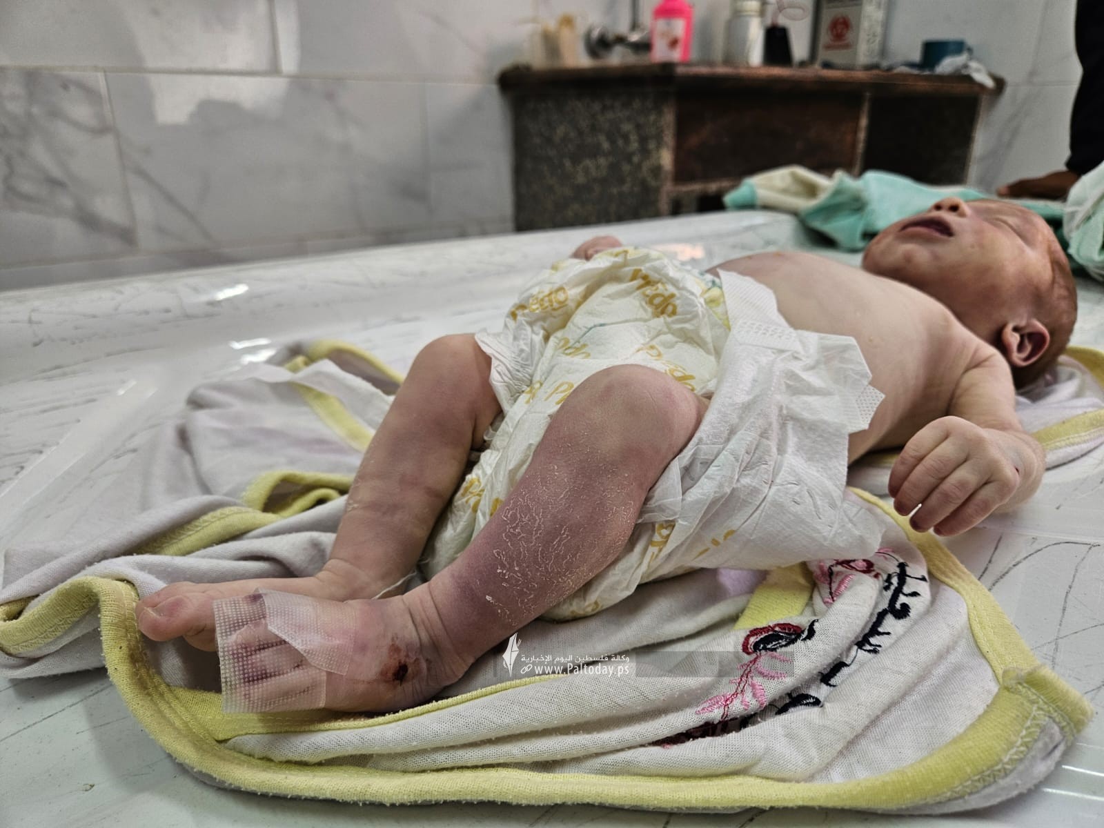 للمرة الثانية…وفاة رضيعة تجمدت من البرد القارس في خيام مواصي خانيونس